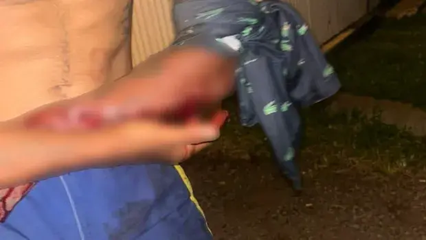 Linfo.re - Individu ayant agressé trois personnes au sabre